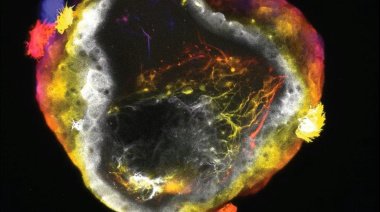 Crean neurobots con células vivas capaces de autoorganizar su “inteligencia”