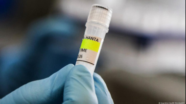 Salud confirmó 102 casos de hantavirus en Argentina