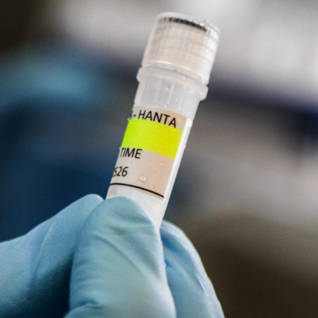 Salud confirmó 102 casos de hantavirus en Argentina